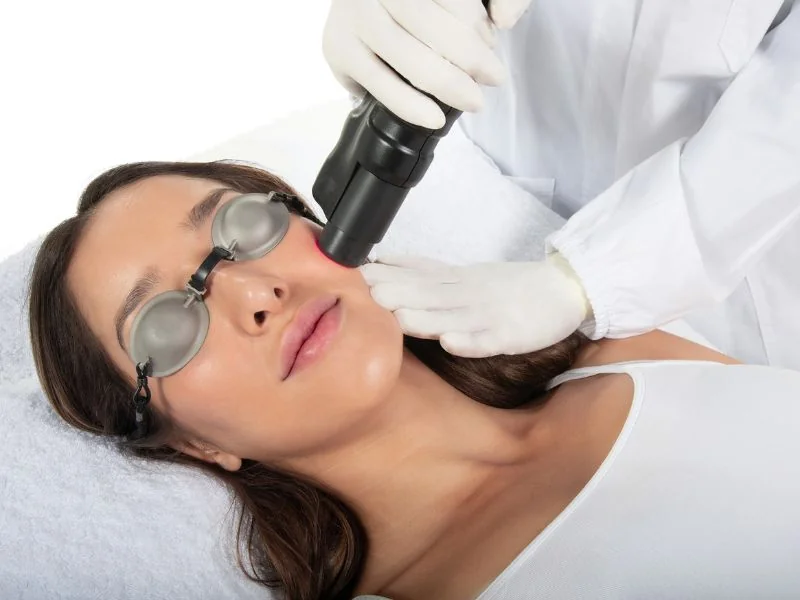 Red Touch Pro laser wolumetryczny na twarz w Boska Beauty Clinic Łódź